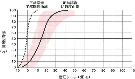 スピーチオージオグラム