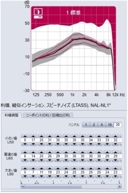 ＰＣ⁻補聴器調整画面