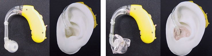 耳掛型‐イヤチップ‐イヤモールド‐対比‐画像