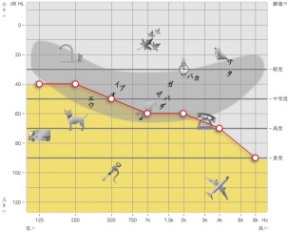 オージオグラム