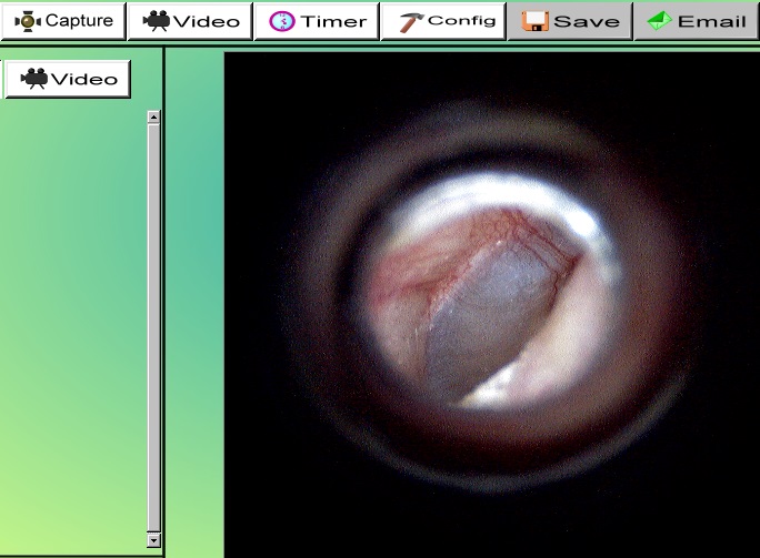 ＵＳＢオトスコープ‐ＰＣ画像